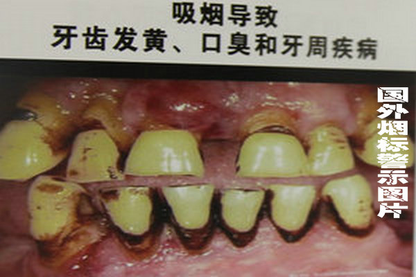 烟草企业模糊危害信息 北京市消协强烈呼吁“图片警示”