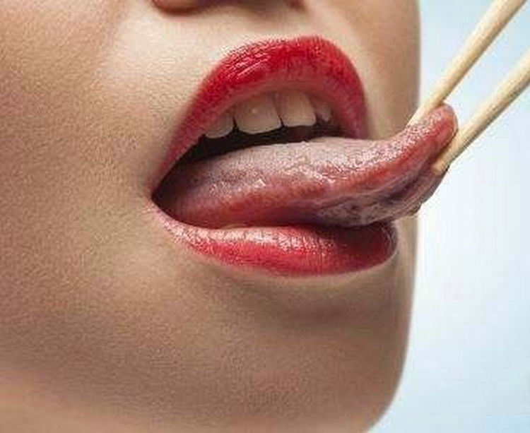 舌苔胖大有齿痕说明你身体已经出现了这些问题！！！